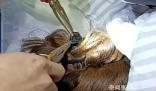 女子出車禍鯊魚夾插入后腦勺