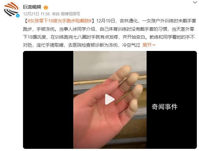 女孩零下18度戶外光手跑步險截肢 室外運動防寒真不是小事