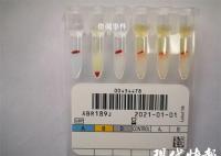江蘇泰州發現罕見小p血型 我國記錄在案的小p血型僅有10余人