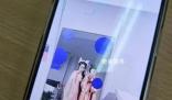 女子拍完寫真全身癢到抓出血