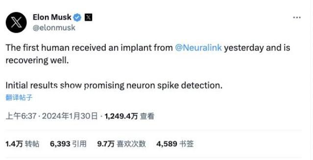 馬斯克稱人類首次植入腦機接口芯片