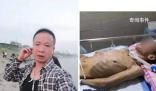 老人扶倒地者卻被車撞成植物人
