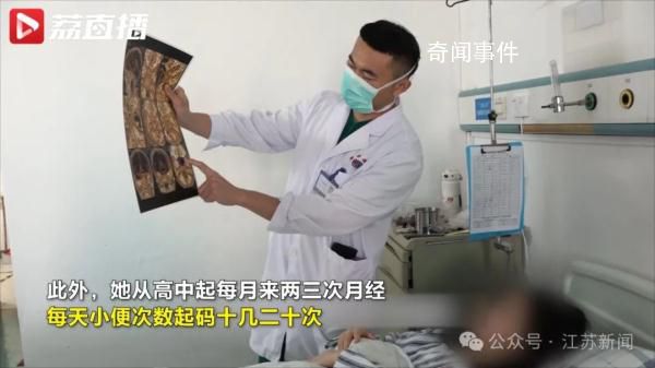 女生每月3次月經 腦部查出垂體瘤